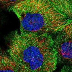 TMEM218 Antibody, Novus Biologicals:Antibodies:Primary Antibodies